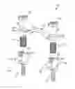 Fig. 01 - Rod attachment for head to head cross connector