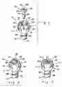 Fig. 02 - Orthopedic anchor assembly