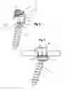 Fig. 03 - Bone anchoring device