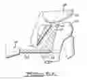 Fig. 04 - Apparatus and method for tibial fixation of soft tissue