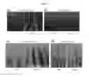 Fig. 09 - OsMPT gene for modifying plant architecture and increasing yield, and uses thereof