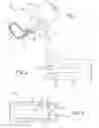 Fig. 02 - METHOD AND APPARATUS FOR SAFE STORAGE OR DISPOSAL OF RAZORS