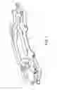 Fig. 02 - Adjustable rate leaf spring suspension