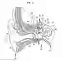 Fig. 02 - Identifying hearing prosthesis actuator resonance peak(s)
