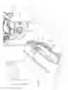 Fig. 02 - Phased array MR RF coil which is not visible in X-ray image