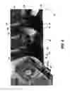 Fig. 06 - Configurable desegregation apparatus