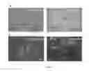 Fig. 06 - CELL POPULATION COMPRISING ORBITAL FAT-DERIVED STEM CELLS (OFSCS) AND THEIR ISOLATION AND APPLICATIONS