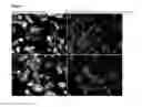 Fig. 02 - Pneumovirus compositions and methods for using the same