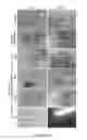 Fig. 06 - Interpenetrating polymer network comprising fibrin