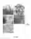 Fig. 08 - Interpenetrating polymer network comprising fibrin