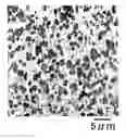 Fig. 01 - Photosensitive resin composition, printing plate precursor and flexographic printing plate