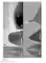 Fig. 35 - Controlled tunnel gap device for sequencing polymers