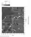 Fig. 75 - Methods for manufacturing low noise chemically-sensitive field effect transistors