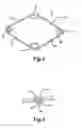 Fig. 02 - EXTENSION RING FOR EYEBALL TISSUE