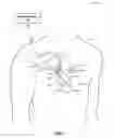 Fig. 02 - Techniques for determining morphological stability of cardiac cycles