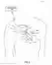 Fig. 03 - Techniques for determining cardiac cycle morphology