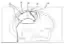 Fig. 01 - Systems and methods for treating pain using brain stimulation