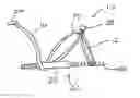 Fig. 01 - Boutonniere deformity ring splint