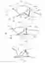 Fig. 02 - Boutonniere deformity ring splint