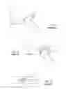 Fig. 02 - Systems, devices, and methods for mechanically reducing and fixing bone fractures