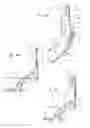 Fig. 45 - Systems, devices, and methods for mechanically reducing and fixing bone fractures