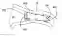 Fig. 01 - Methods, Devices, Kits and Systems for Defunctionalizing the Cystic Duct