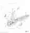 Fig. 02 - Methods, Devices, Kits and Systems for Defunctionalizing the Cystic Duct