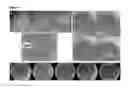 Fig. 08 - System and methods for motorized injection and aspiration