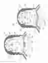 Fig. 15 - Needle for bloodless IV