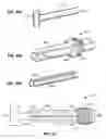 Fig. 32 - Method and apparatus for gastrointestinal tract ablation to achieve loss of persistent and/or recurrent excess body weight following a weight loss operation
