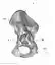 Fig. 01 - Customized surgical guides, methods for manufacturing and uses thereof