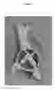 Fig. 02 - Customized surgical guides, methods for manufacturing and uses thereof