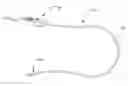Fig. 01 - Mitral valve repair system and method for use