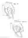 Fig. 22 - Mitral valve repair system and method for use