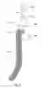 Fig. 07 - Anchors for bodily implants and methods for anchoring bodily implants into a patient's body