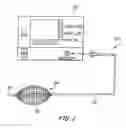 Fig. 02 - Balloon catheter mesh