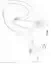 Fig. 10 - Methods and devices for recanalization of occluded body vessels using a double-sided guidewire