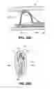 Fig. 22 - SYSTEMS AND METHODS FOR ENDOLUMINAL VALVE CREATION