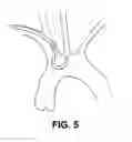 Fig. 09 - INTRAVASCULAR BLOOD FILTERS AND METHODS OF USE