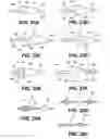 Fig. 22 - INTRAVASCULAR BLOOD FILTERS AND METHODS OF USE