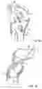 Fig. 02 - TISSUE GRAFT ANCHORING