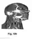 Fig. 09 - Method for achieving facial toning using selectively applied galvanic current