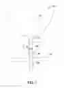 Fig. 02 - Pre-Positioned Anastomosis Device and Related Methods of Use