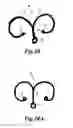 Fig. 09 - INTRAOCULAR CAPSULAR TENSION RINGS