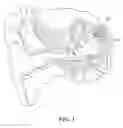 Fig. 02 - Incus Replacement Partial Ossicular Replacement Prosthesis