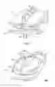 Fig. 02 - Transforaminal prosthetic spinal disc apparatus