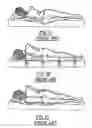 Fig. 02 - Massaging bed
