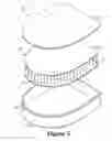 Fig. 06 - Tethered fluid-filled chambers