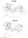 Fig. 20 - Coupler