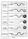 Fig. 23 - Vortex controlled variable flow resistance device and related tools and methods